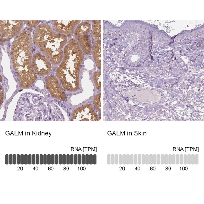 GALM Antibody