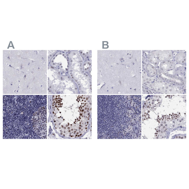 PPM1G Antibody in Immunohistochemistry (IHC)