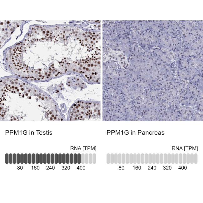 PPM1G Antibody