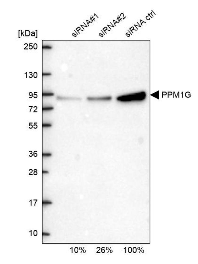 PPM1G Antibody in Western Blot (WB)