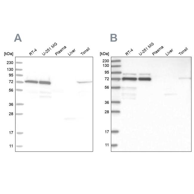 PPM1G Antibody in Western Blot (WB)