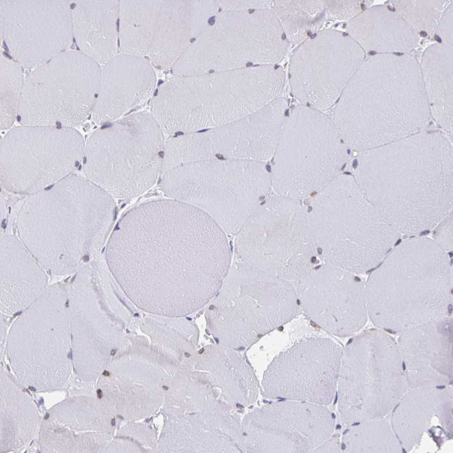 TRH Antibody in Immunohistochemistry (IHC)