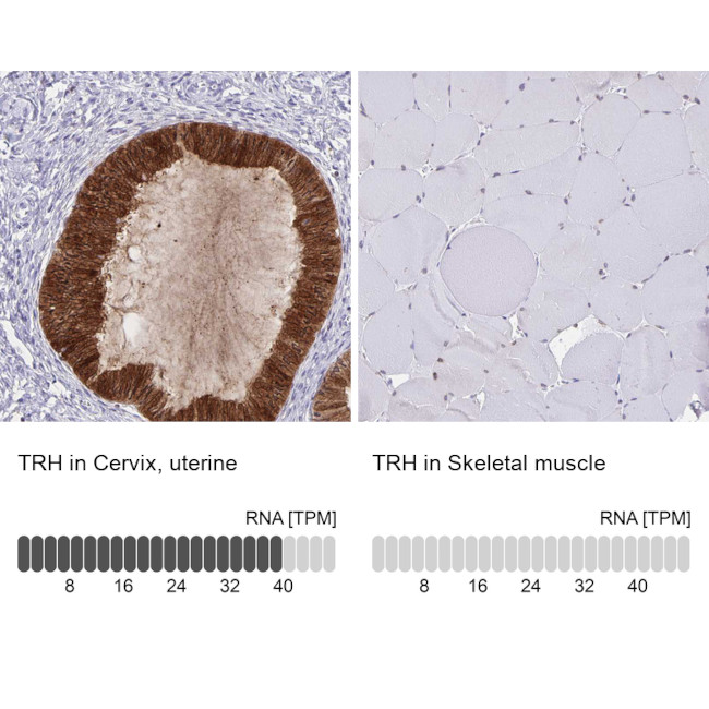 TRH Antibody