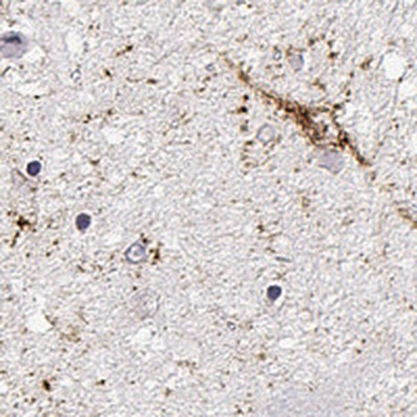 TRH Antibody in Immunohistochemistry (IHC)