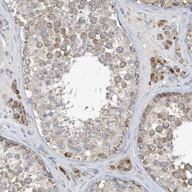 CLEC16A Antibody in Immunohistochemistry (IHC)