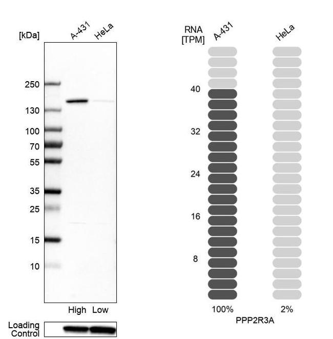 PPP2R3A Antibody in Western Blot (WB)