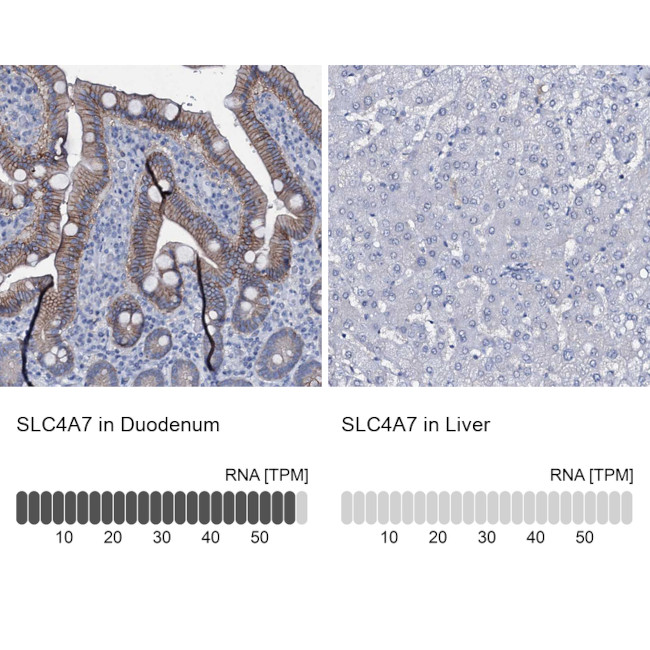 SLC4A7 Antibody in Immunohistochemistry (IHC)