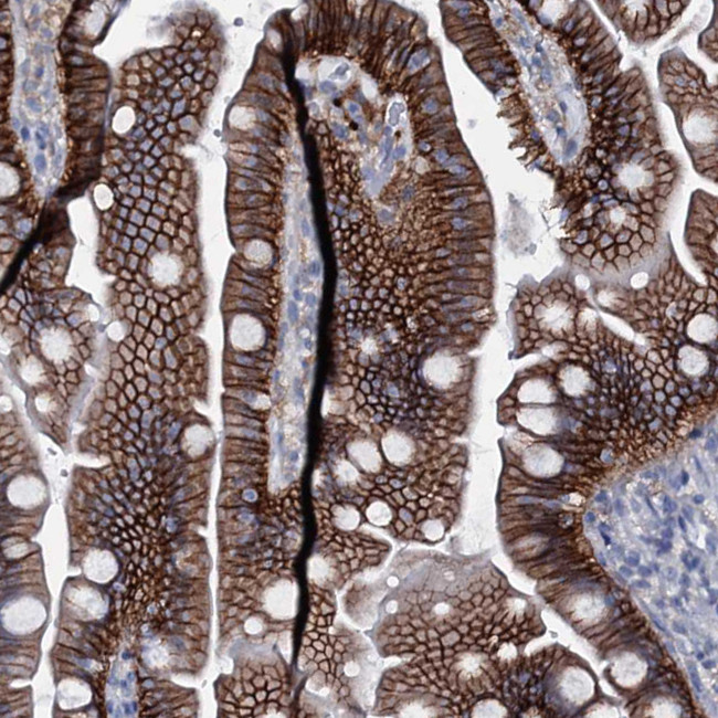 SLC4A7 Antibody in Immunohistochemistry (IHC)