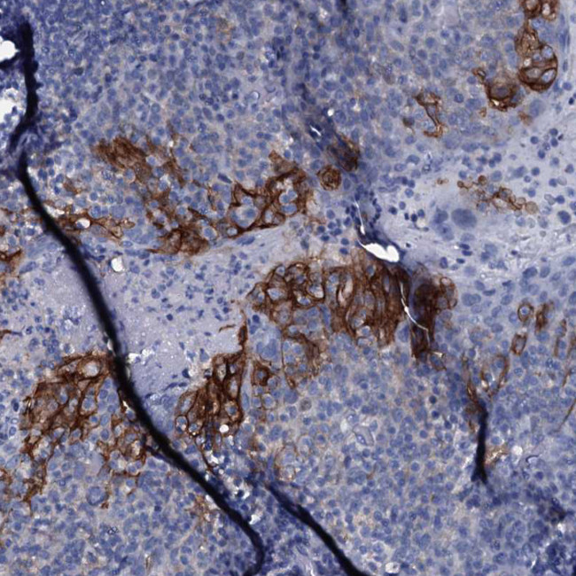 SLC4A7 Antibody in Immunohistochemistry (IHC)