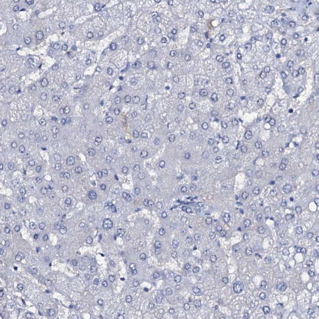 SLC4A7 Antibody in Immunohistochemistry (IHC)