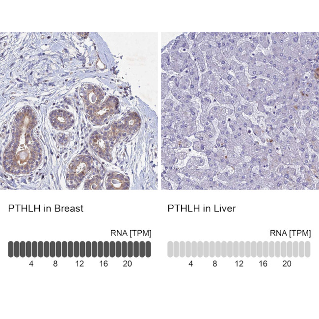 PTHLH Antibody in Immunohistochemistry (IHC)