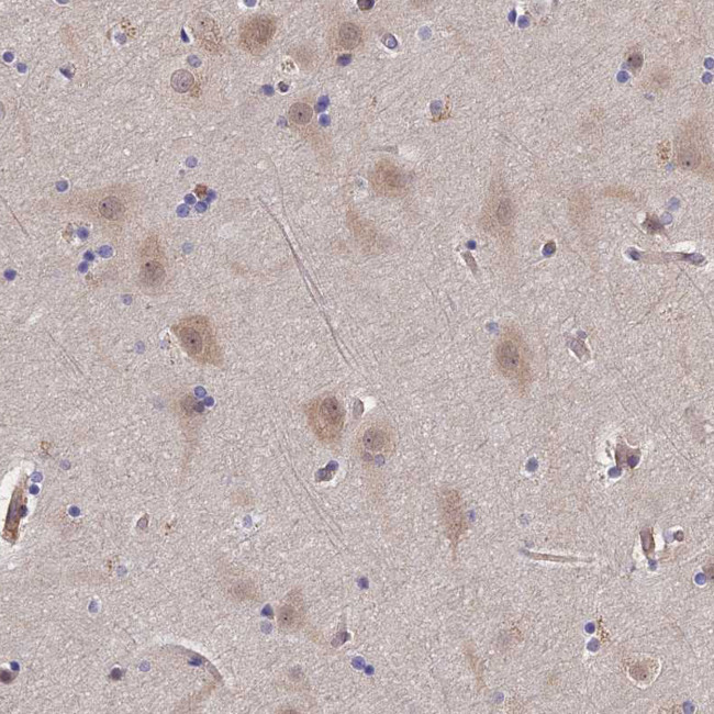 PTHLH Antibody in Immunohistochemistry (IHC)