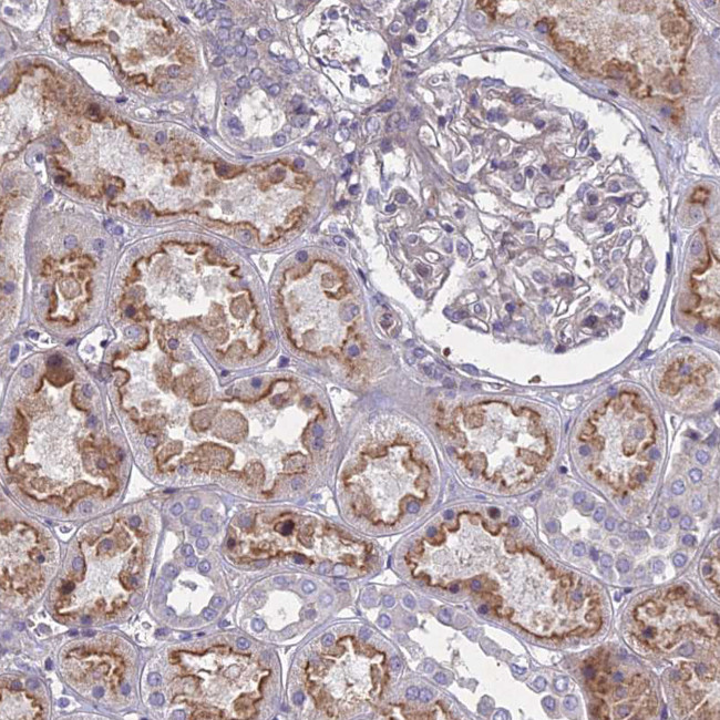 PTHLH Antibody in Immunohistochemistry (IHC)