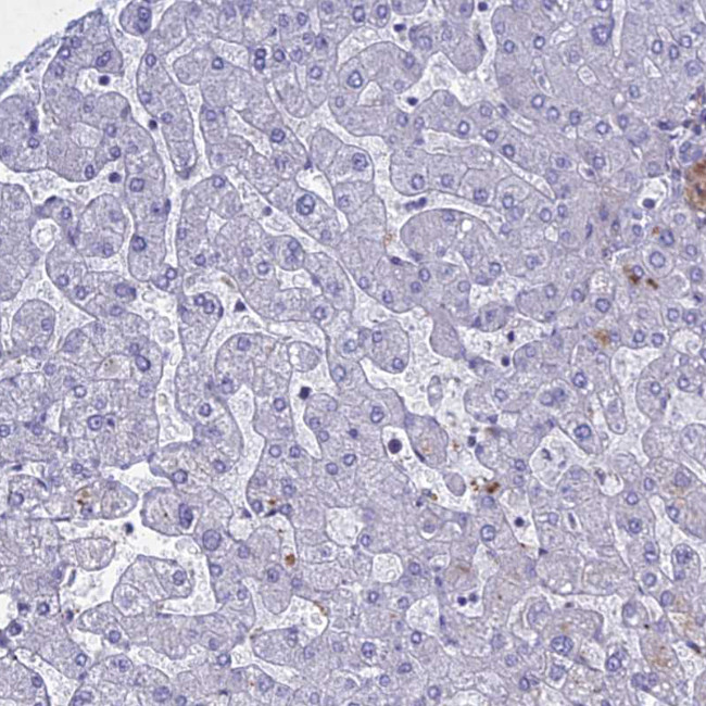 PTHLH Antibody in Immunohistochemistry (IHC)