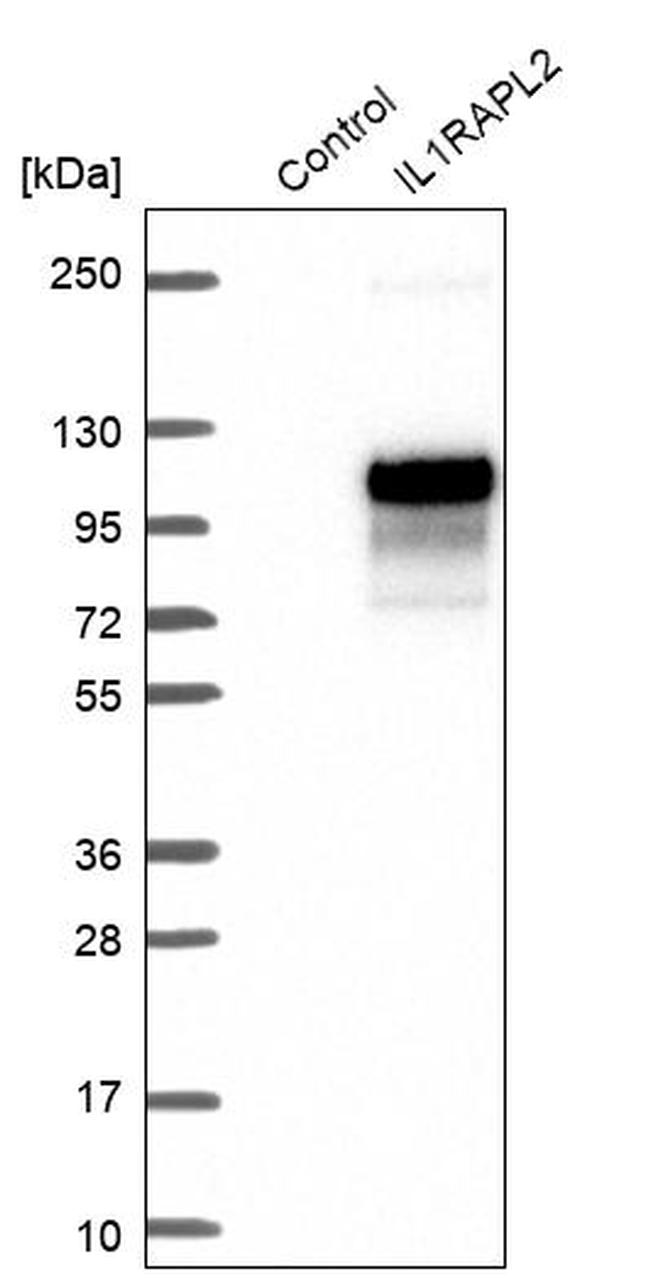 IL1RAPL2 Antibody in Western Blot (WB)