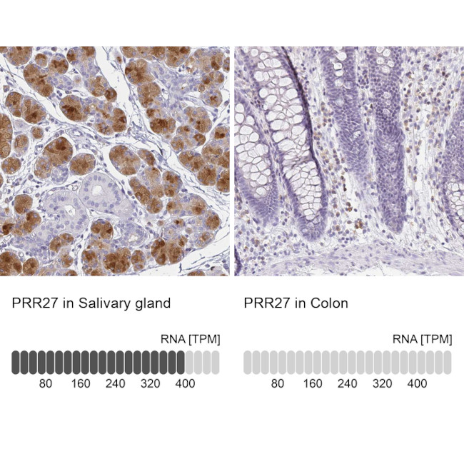 PRR27 Antibody in Immunohistochemistry (IHC)