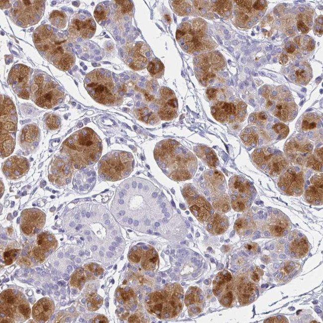 PRR27 Antibody in Immunohistochemistry (IHC)