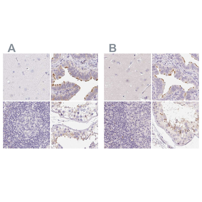 ZBBX Antibody in Immunohistochemistry (IHC)