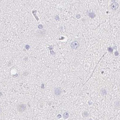 ZBBX Antibody in Immunohistochemistry (IHC)