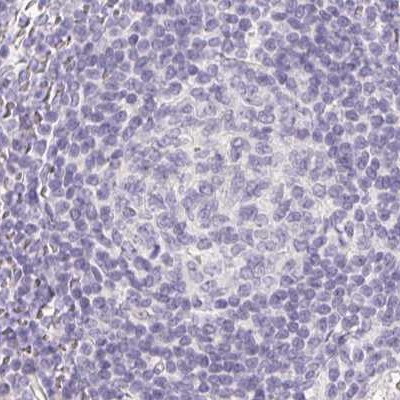 ZBBX Antibody in Immunohistochemistry (IHC)