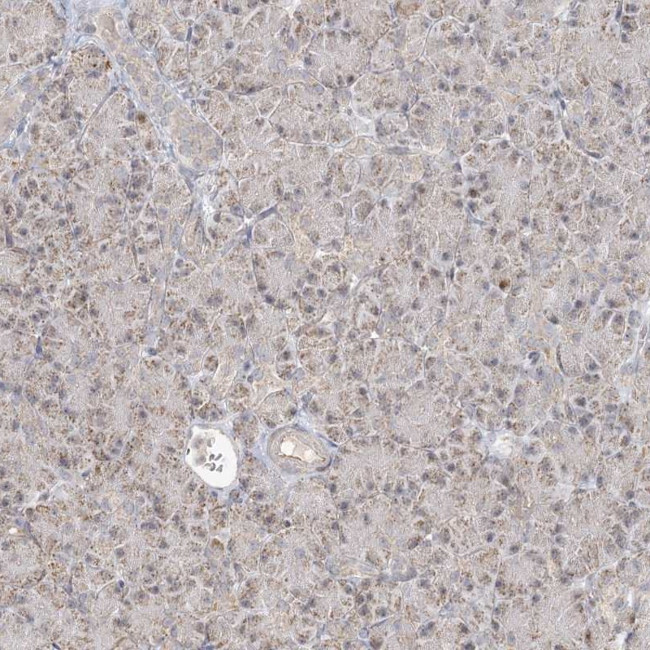 LACTB Antibody in Immunohistochemistry (IHC)