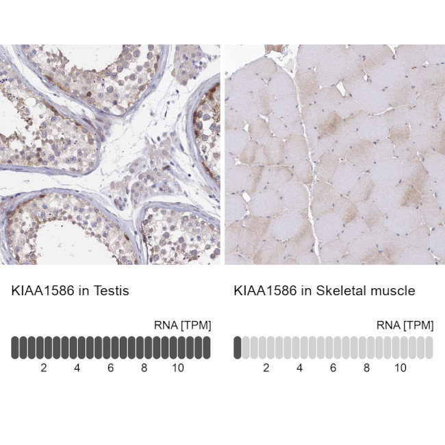 KIAA1586 Antibody in Immunohistochemistry (IHC)