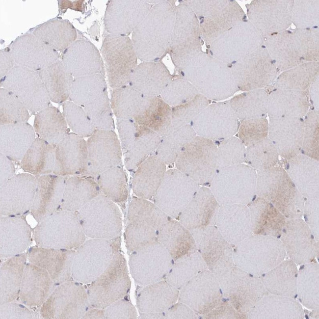 KIAA1586 Antibody in Immunohistochemistry (IHC)