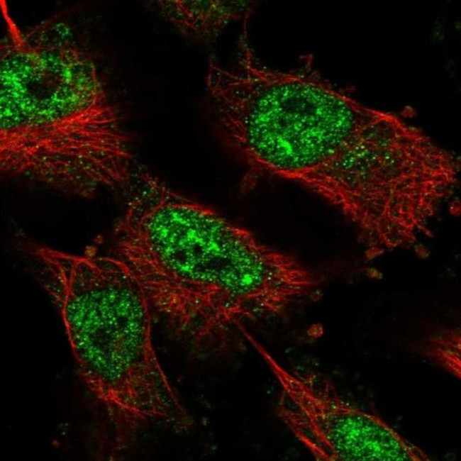 ZNF821 Antibody in Immunocytochemistry (ICC/IF)