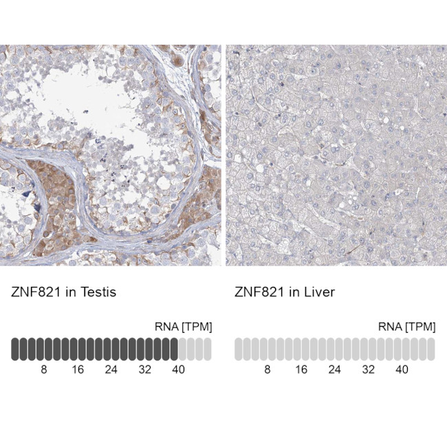 ZNF821 Antibody in Immunohistochemistry (IHC)