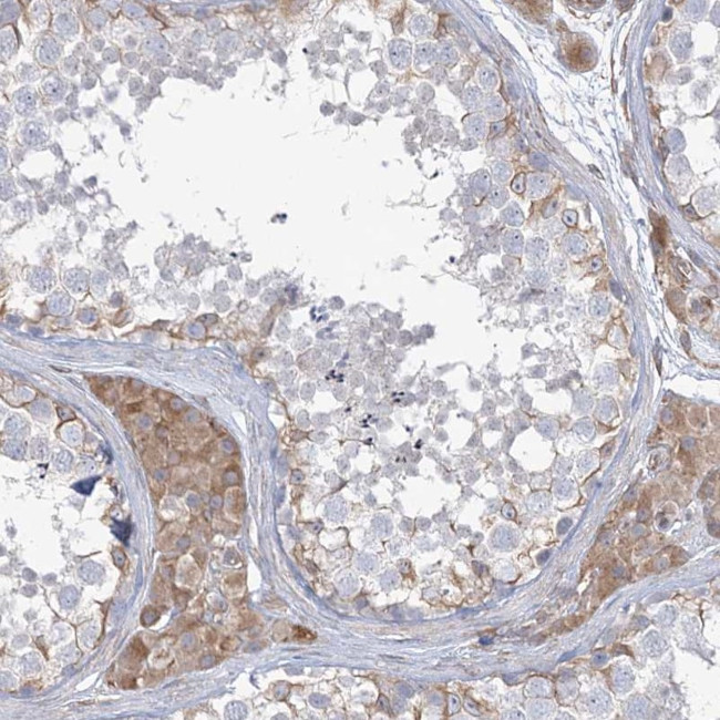 ZNF821 Antibody in Immunohistochemistry (IHC)