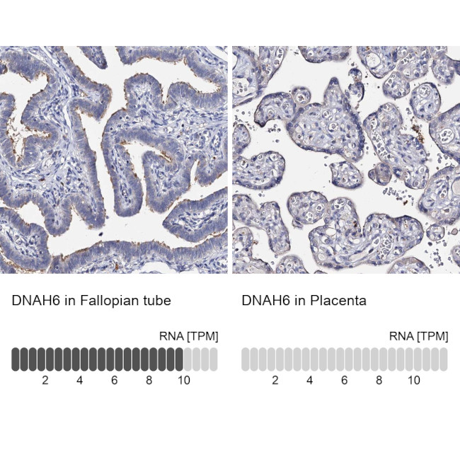 DNAH6 Antibody in Immunohistochemistry (IHC)