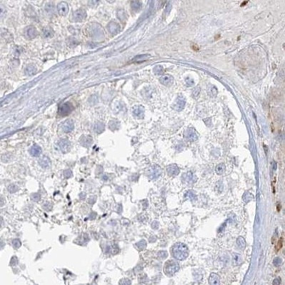 HAAO Antibody in Immunohistochemistry (IHC)