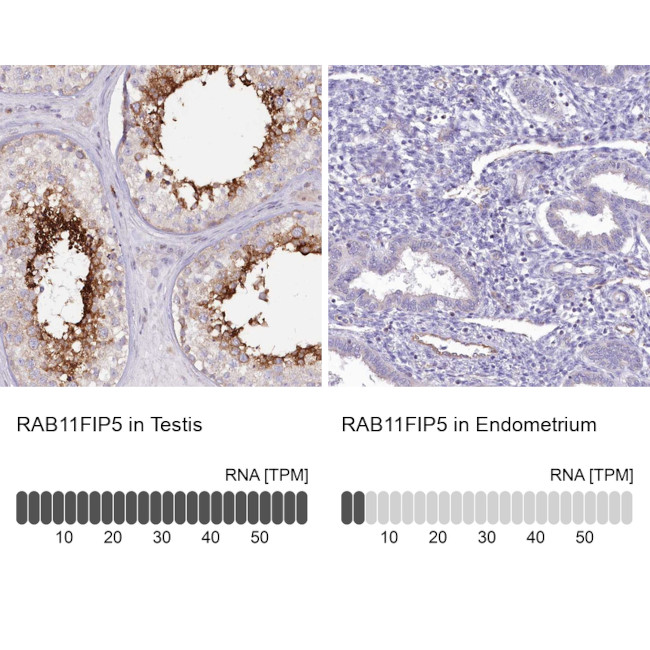 RAB11FIP5 Antibody in Immunohistochemistry (IHC)