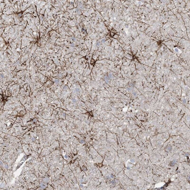 ARSJ Antibody in Immunohistochemistry (IHC)