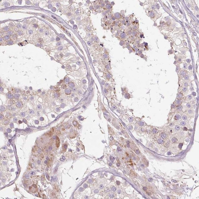 PDZD2 Antibody in Immunohistochemistry (IHC)