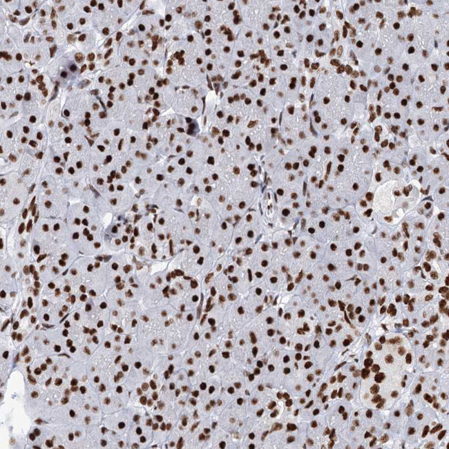 MATR3 Antibody in Immunohistochemistry (IHC)