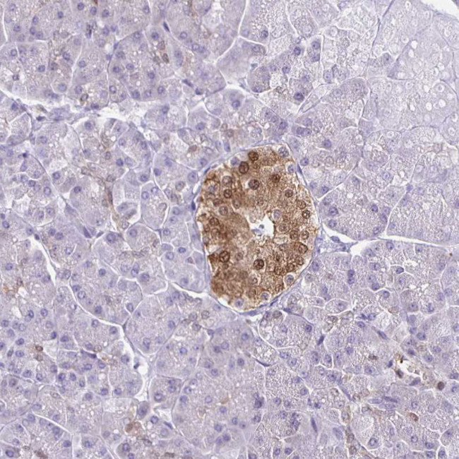 TPPP Antibody in Immunohistochemistry (IHC)