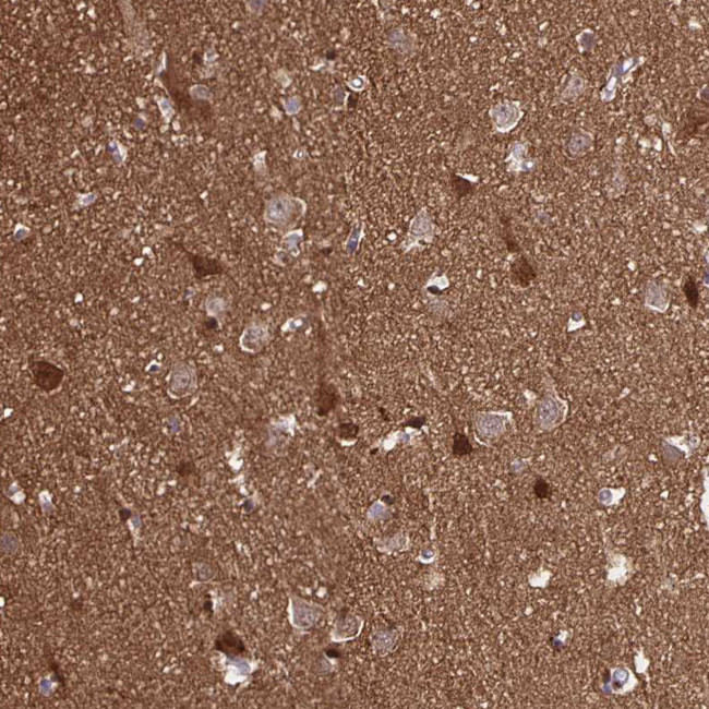 TPPP Antibody in Immunohistochemistry (IHC)