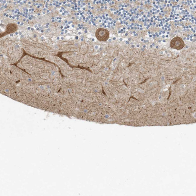 FAM35A Antibody in Immunohistochemistry (IHC)