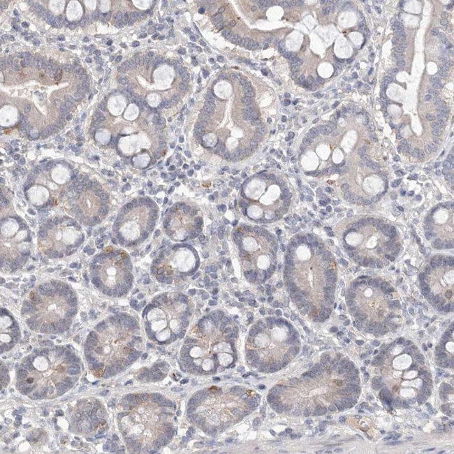 DPCD Antibody in Immunohistochemistry (IHC)