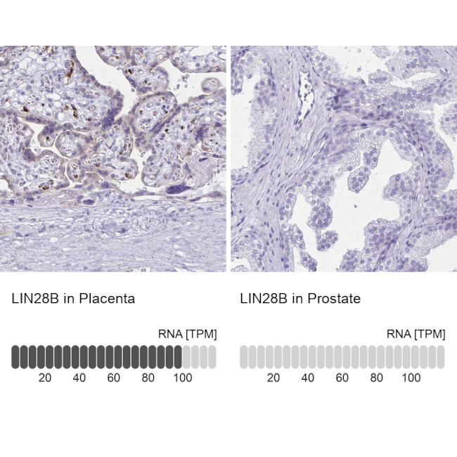 LIN28B Antibody in Immunohistochemistry (IHC)