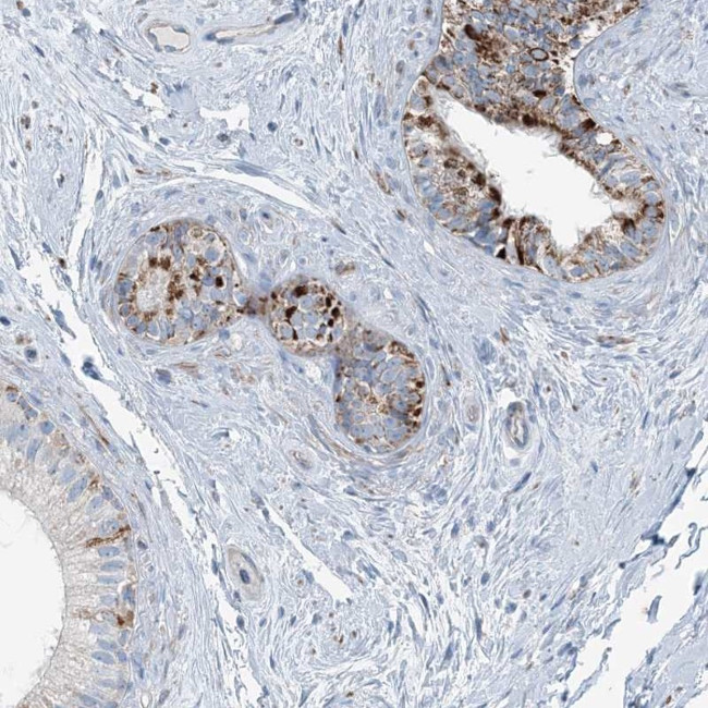 INTU Antibody in Immunohistochemistry (IHC)