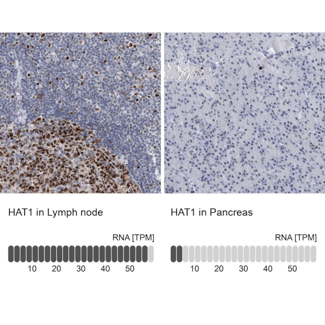 HAT1 Antibody in Immunohistochemistry (IHC)