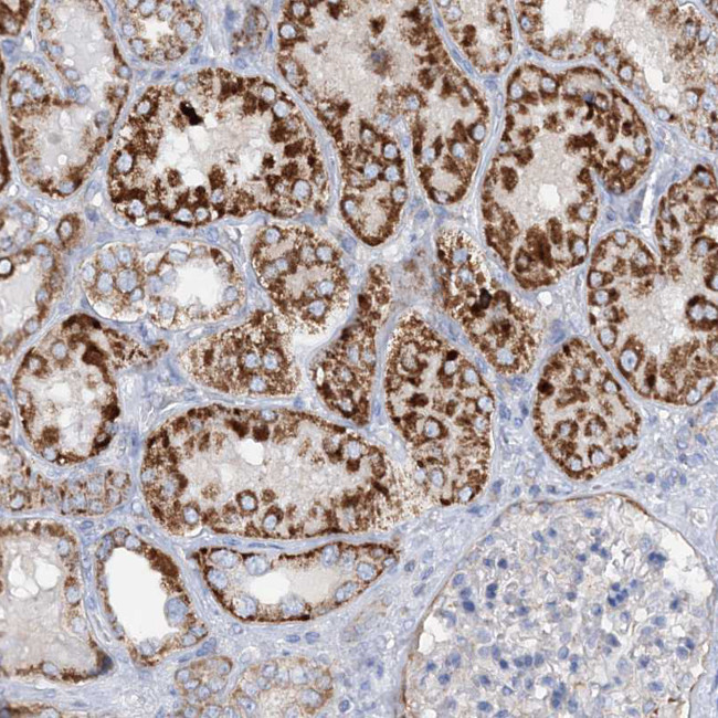 NGLY1 Antibody in Immunohistochemistry (IHC)