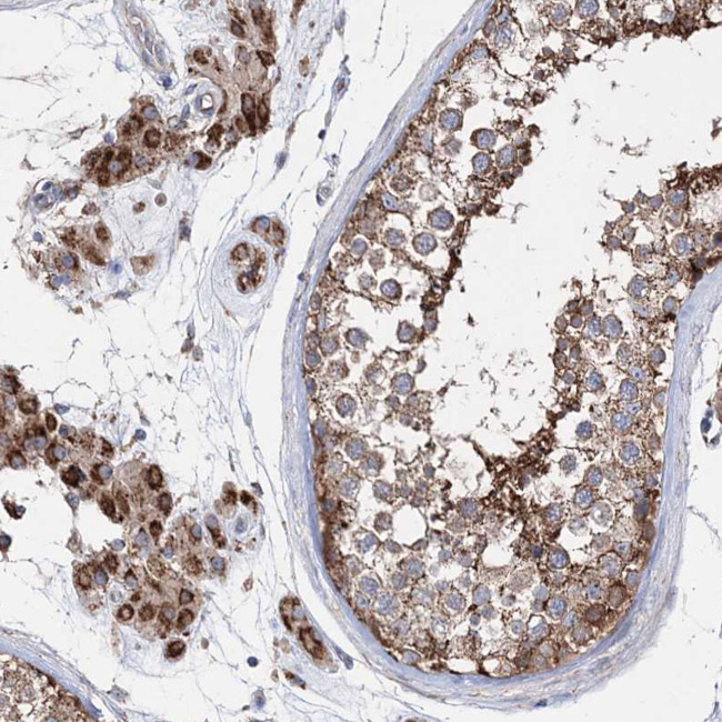 NGLY1 Antibody in Immunohistochemistry (IHC)