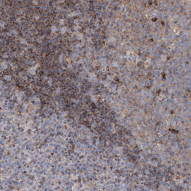 NGLY1 Antibody in Immunohistochemistry (IHC)