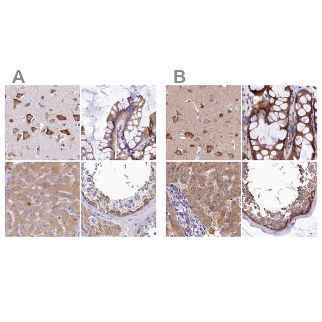 QARS Antibody in Immunohistochemistry (IHC)