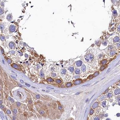 QARS Antibody in Immunohistochemistry (IHC)