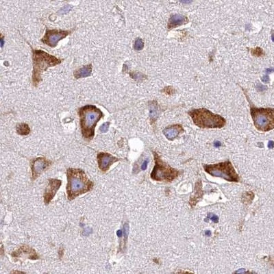 QARS Antibody in Immunohistochemistry (IHC)