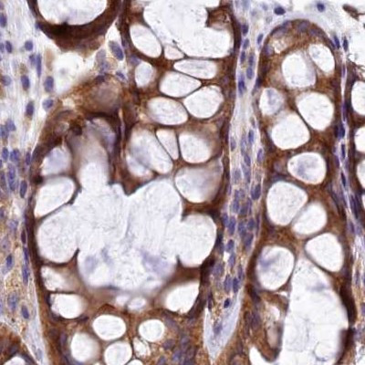 QARS Antibody in Immunohistochemistry (IHC)